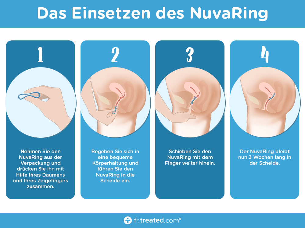 Nuvaring Anwendung